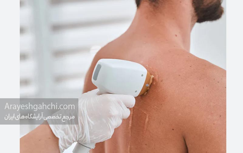 لیزر دایود برای آقایان