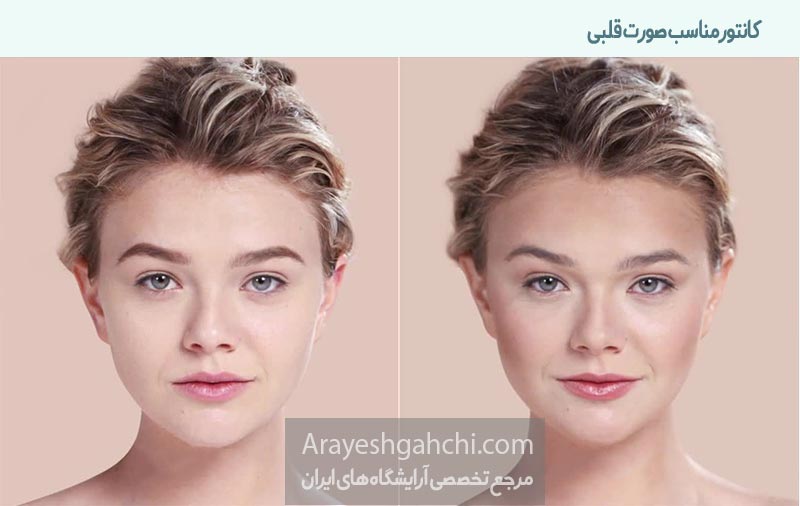 کانتور مناسب صورت قلبی