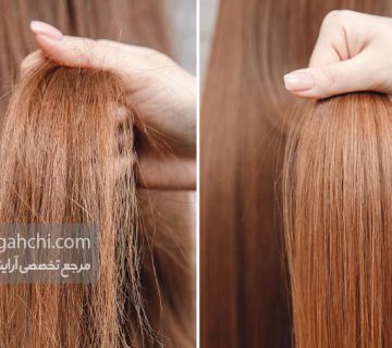 مراقبت های بعد از کراتینه