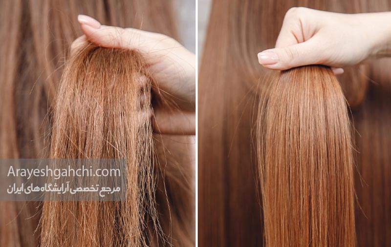مراقبت های بعد از کراتینه