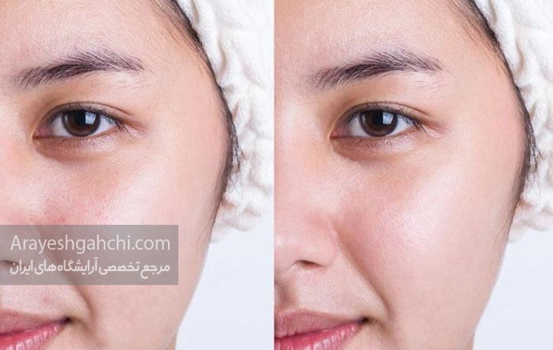 استفاده از پرایمر