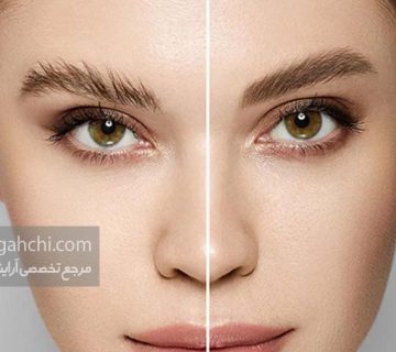 میکروبلیدینگ ابرو