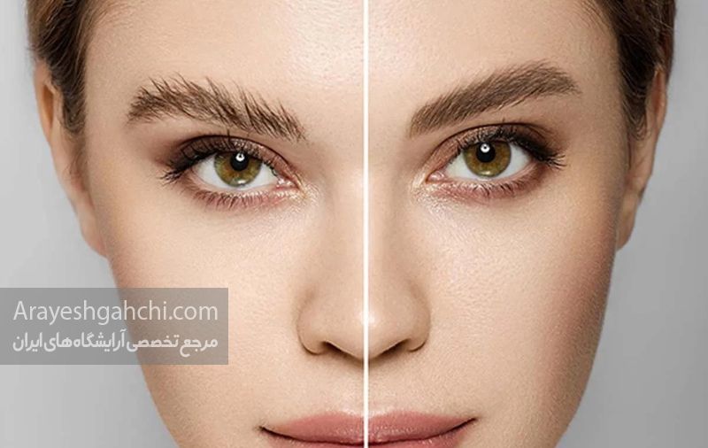 میکروبلیدینگ ابرو