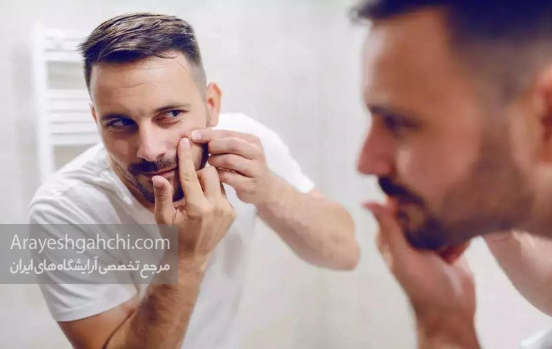 استفاده از ضدجوش