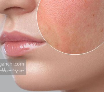 روتین پوست خشک
